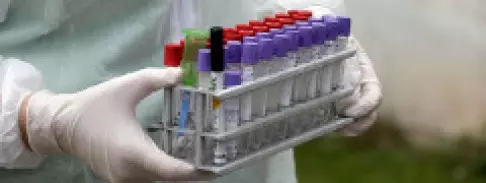 Ricin, pestis, botulizmus: a labortakarítás eddigi mérlege
