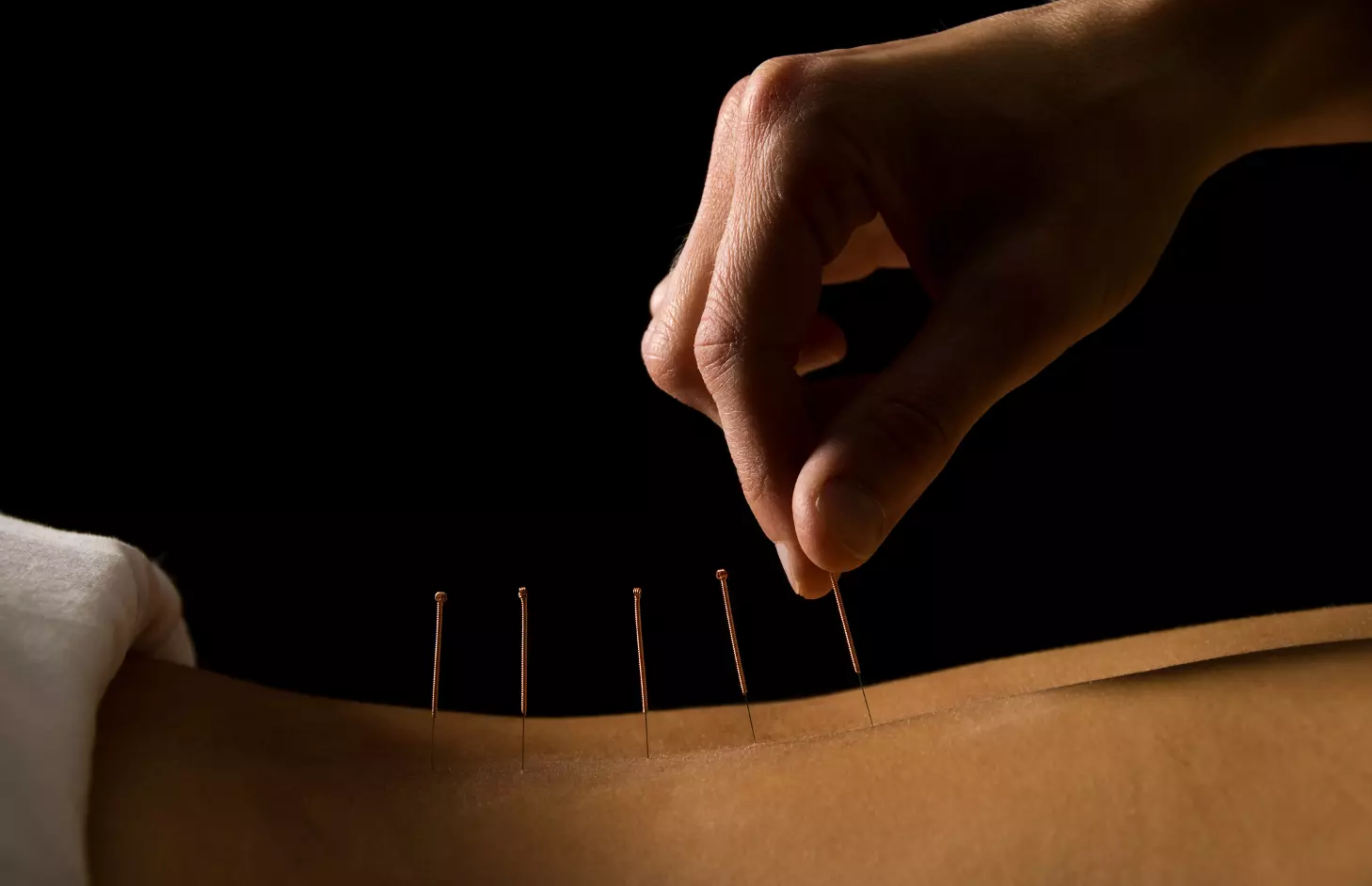 anti aging akupunktúra vélemények san diego öregedésgátló bb krém uk