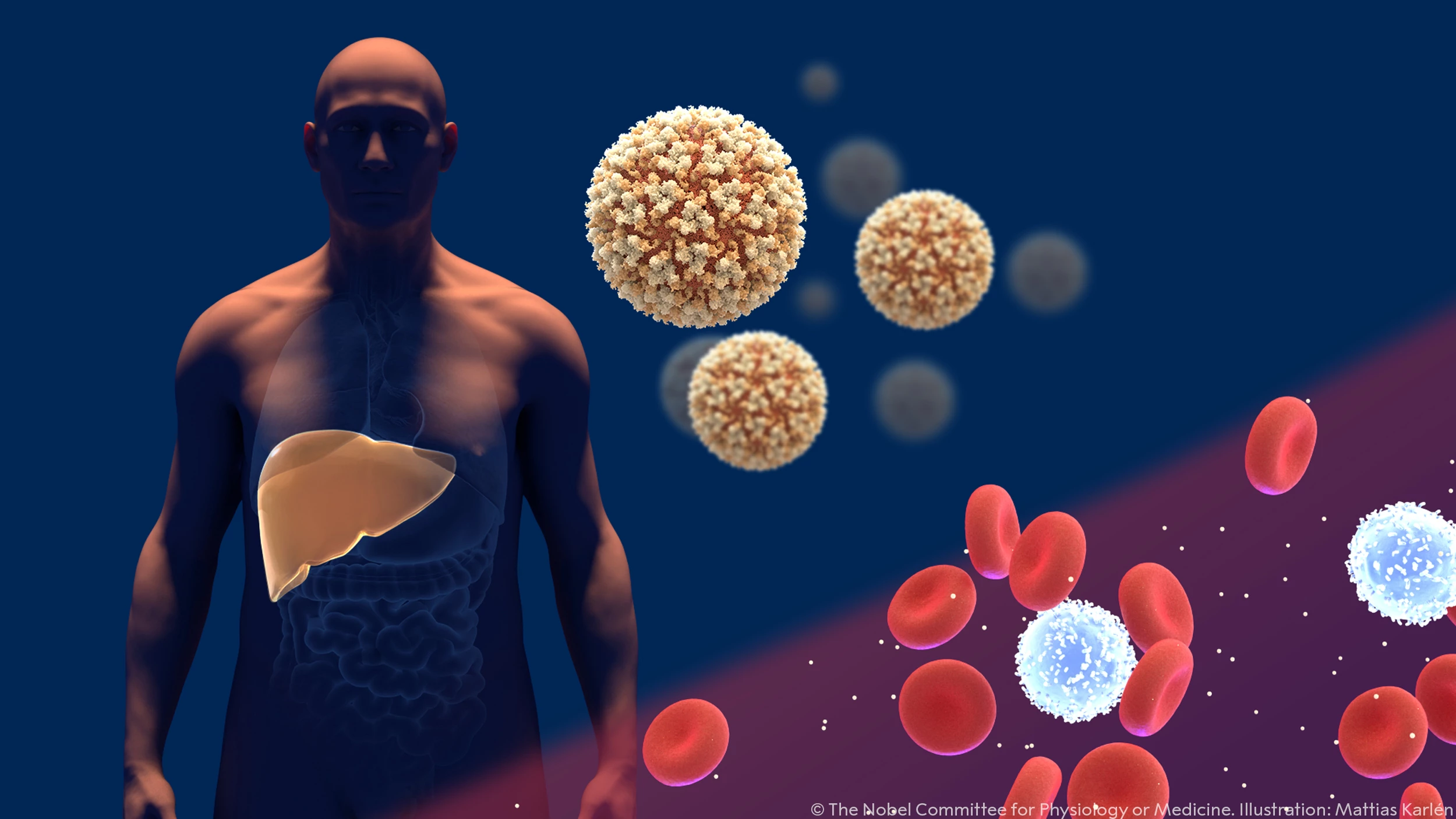 A hepatitis C-vírus felfedezői kapták az idei orvosi Nobel-díjat